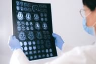Alzheimer's disease is a brain disorder. (Photo via Pexels/Anna Shvets)